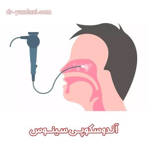 آندوسکوپی سینوس - دکتر جوادی یزدانی