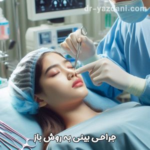 جراحی بینی به روش باز - دکتر جواد یزدانی