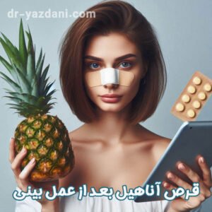 آناهیل بعد از عمل بینی - دکتر جواد یزدانی