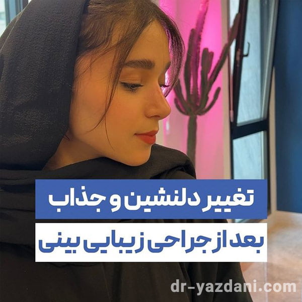 نمونه کار عمل بینی دکتر جواد یزانی