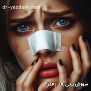 سوزش بینی بعد از عمل - دکتر جواد یزدانی