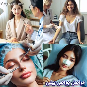 مراحل جراحی بینی - دکتر جواد یزدانی
