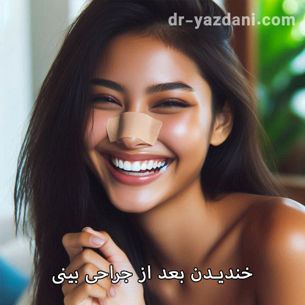 خندیدن بعد از عمل بینی - دکتر جواد یزدانی