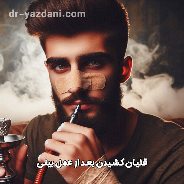 قلیان کشیدن بعد از عمل بینی - دکتر جواد یزدانی