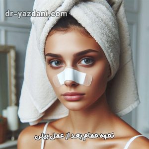 حمام بعد از جراحی بینی - دکتر جواد یزدانی