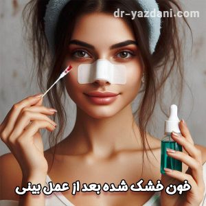 خون خشک شده داخل بینی بعد از عمل - دکتر جواد یزدانی