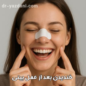 خندیدن بعد از عمل بینی - دکتر جواد یزدانی