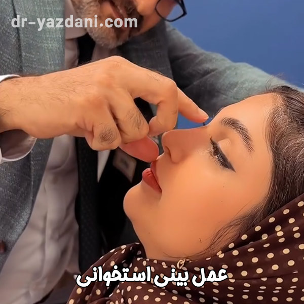 عمل بینی استخوانی - دکتر یزدانی