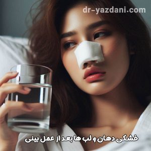 خشکی دهان بعد از عمل بینی - دکتر جواد یزدانی