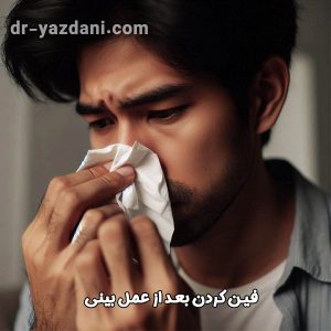 فین کردن بعد از عمل بینی - دکتر جواد یزدانی