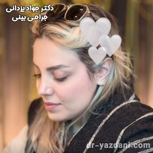 جراحی بینی - دکتر جواد یزدانی 