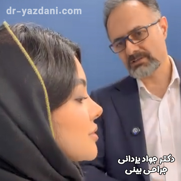 جراحی بینی - دکتر جواد یزدانی