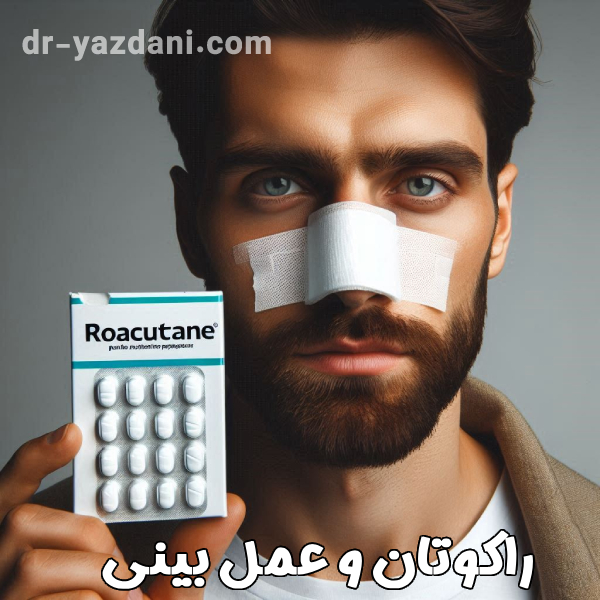 راکوتان و جراحی بینی - دکتر یزدانی