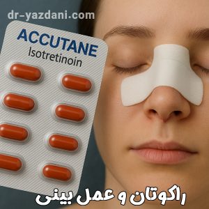 راکوتان و جراحی بینی - دکتر یزدانی