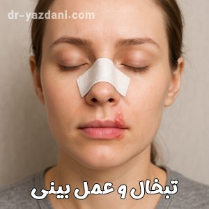 تبخال و عمل بینی - دکتر جواد یزدانی