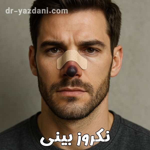 نکروز بینی - دکتر جواد یزدانی