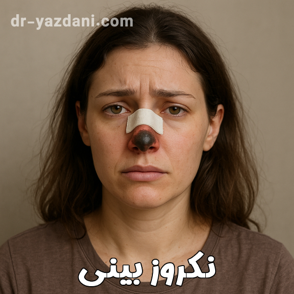 نکروز بینی - دکتر جواد یزدانی