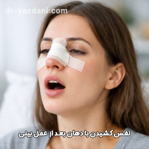 نفس کشیدن با دهان بعد از عمل بینی - دکتر یزدانی