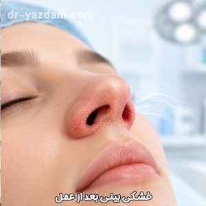 خشکی بینی بعد از عمل - دکتر جواد یزدانی