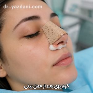 خونریزی بعد از عمل بینی - دکتر جواد یزدانی